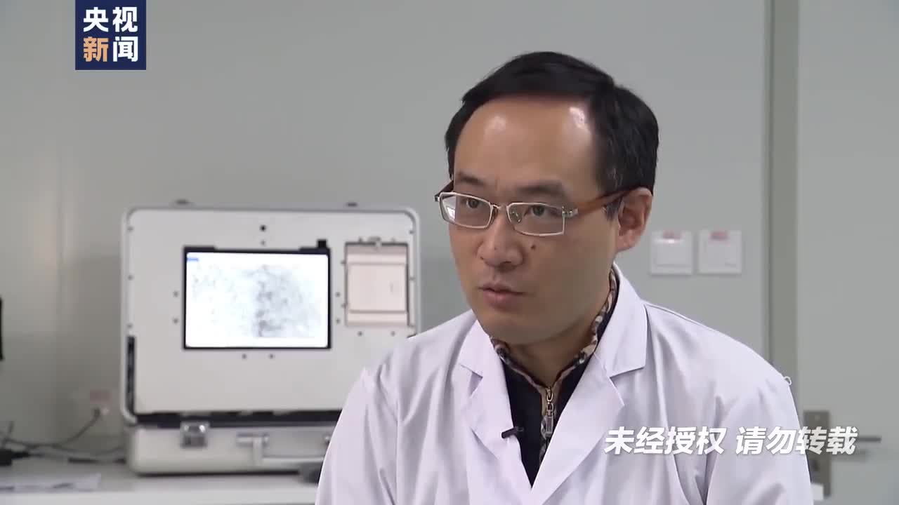 首次揭示！研究发现指纹与身体发育基因关联