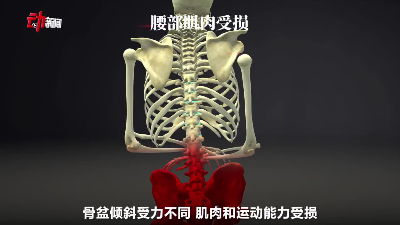 小封科普跷二郎腿对身体有啥影响