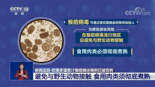 与猴痘感染者密切接触也可能感染