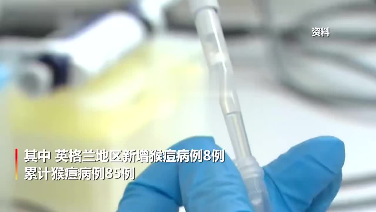 基因测序证实猴痘已大规模社区传播 国卫生官员为6月拉响警报_手机新浪网