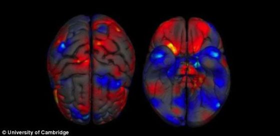 照片展示了这个大脑上面和下面的构造，揭示了灰质容积的差异。红色代表女人大脑较大容积区域，蓝色代表男人大脑较大容积区域。