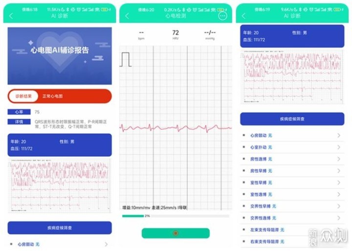 dido心电图E10智能手表，24小时的跟班小大夫_新浪众测