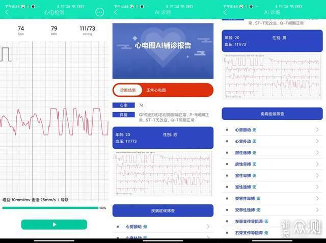 didoE10血压心电手表：随身陪伴的健康管家_新浪众测