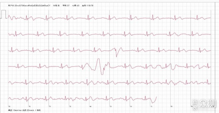 智能健康手表有何不同？实际体验后告诉你答案_新浪众测