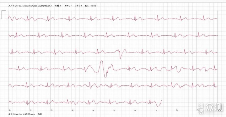 智能健康手表有何不同？实际体验后告诉你答案_新浪众测