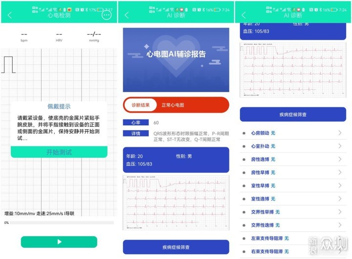 dido E10S血压心电智能手表，关爱家人很放心_新浪众测