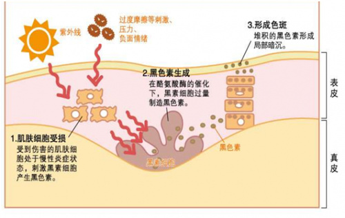 皮肤屏障受损