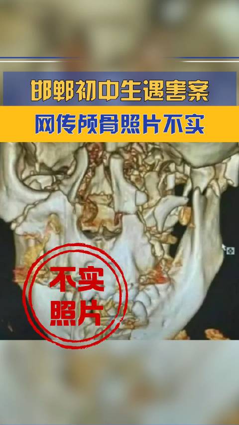 网传颅骨照与邯郸初中生遇害案无关_手机新浪网