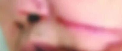 警惕！男子骑摩托过桥时被割脸，“凶器”又是它！