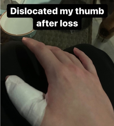 skiter在输了决赛之后大拇指脱臼了