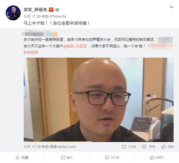 笑笑晒光头照将手术西卡送祝福,miss却说.