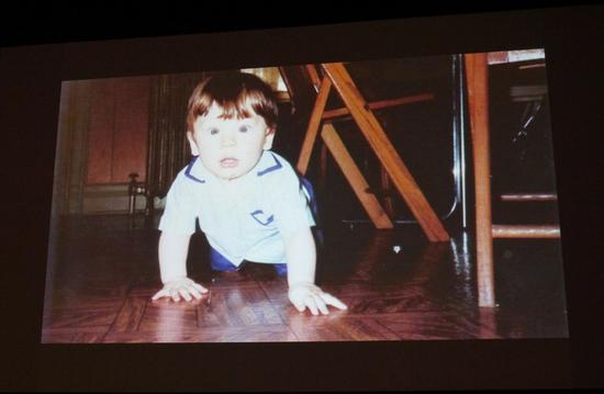 先天就有斗鸡眼而无法两眼直视的詹姆士。