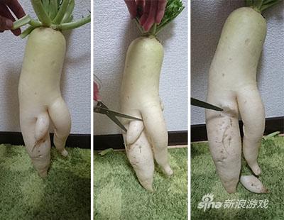 幻肢疼