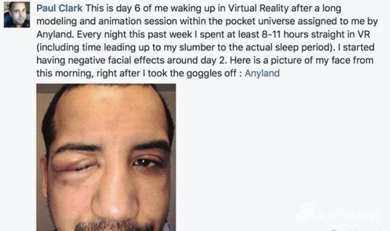 男子沉迷VR佩戴头盔入睡 一觉醒来亲妈都不认识