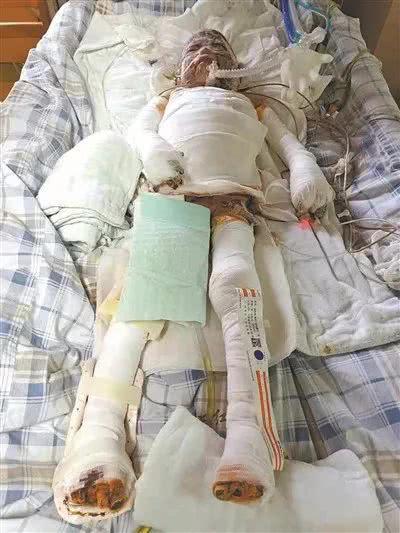 海珠区出租屋里有股怪味 奶奶点了蚊香结果2死1伤