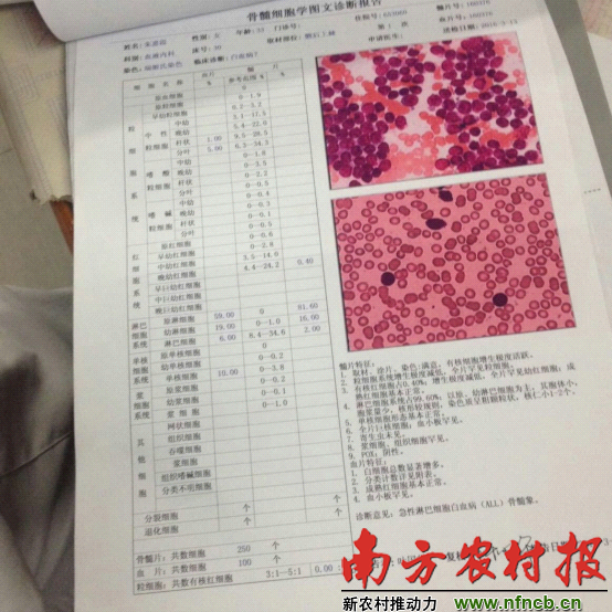 白血病验血报告单图图片