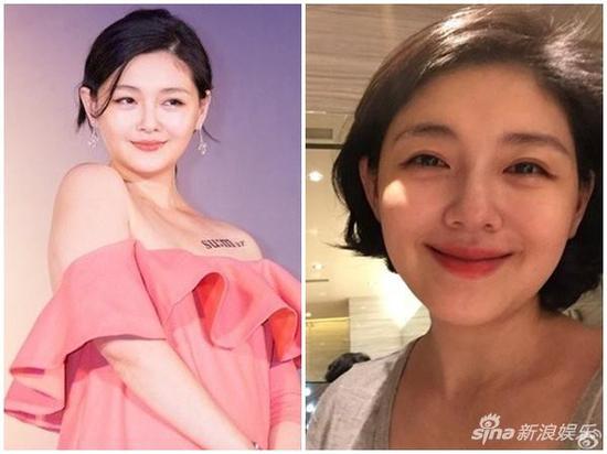 粉丝都很关心大S的身体状况。