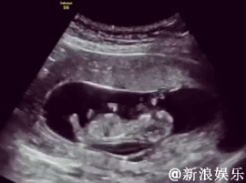 伊能静怀孕秦昊晒b超视频宝宝在肚中滚动