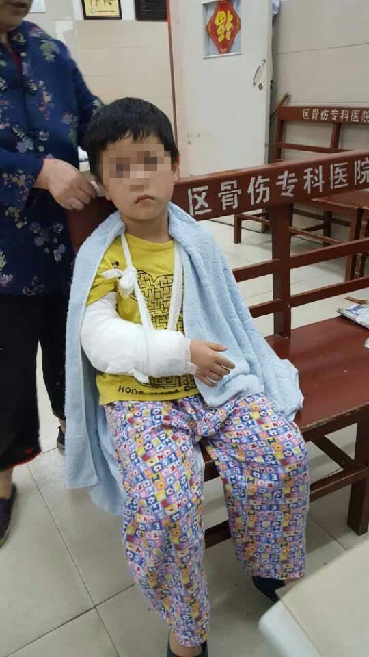 男孩手骨折4家医院说要手术新洲医生2分钟用手复位