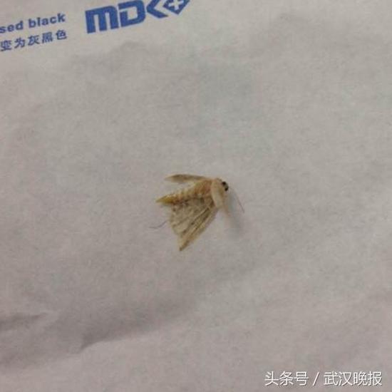 医生从胡先生耳朵里取出的飞蛾