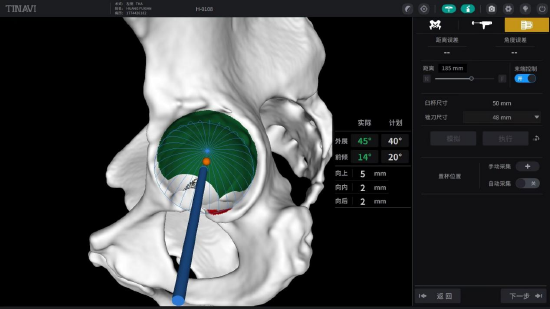 骨科手术机器人对植入角度与位置实时显示、提醒，科技的赋能让操作更精准&nbsp;通讯员张麟供图