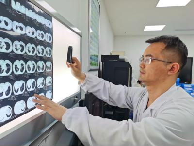 杨澄清在了解一名患者的CT影像变化情况