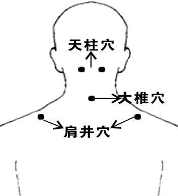武汉市第一医院盘龙城院区针灸科副主任医师邹璟科普颈肩部常用穴位