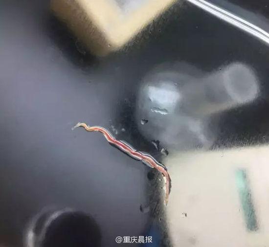 女子咳嗽咳出6条活虫