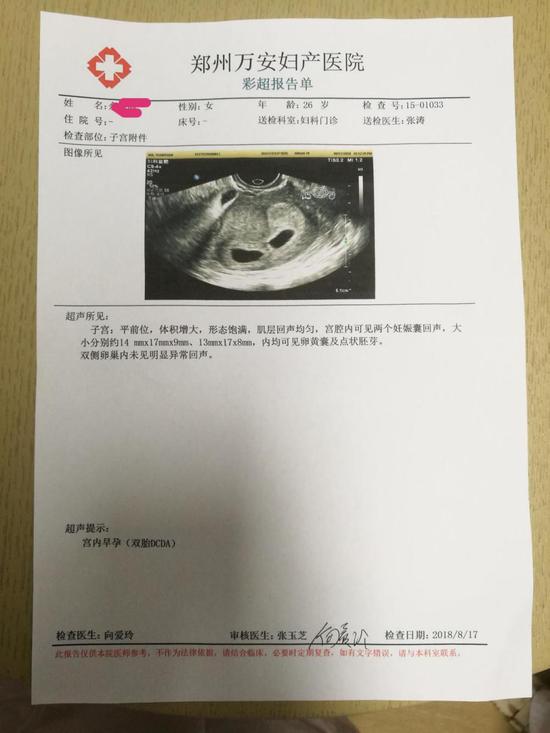 怀孕30天彩超报告图片图片