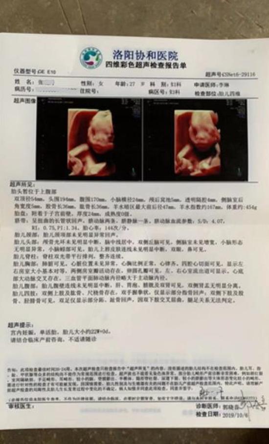 怀孕报告单 彩色图片