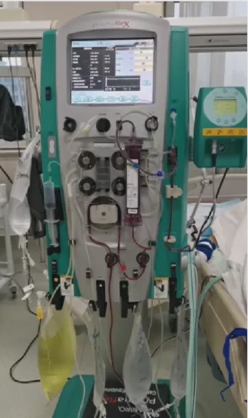 患者血液中分离出的大袋油脂(左下角)