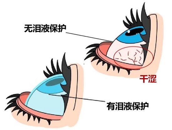 干眼症:现代生活中的"隐形杀手"_新浪黑龙江_新浪网