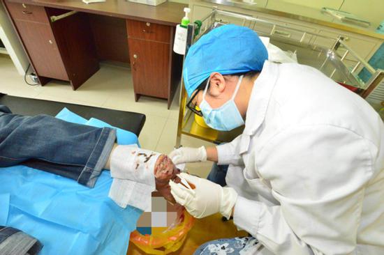 赵晓宇医生为糖尿病足患者换药
