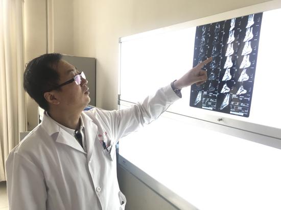 郭勇医生在仔细查看患者的核磁片子 高军震摄