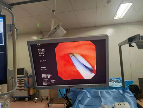 83岁大娘突然吃不下饭哈医大四院消化二科胆管支架显神通