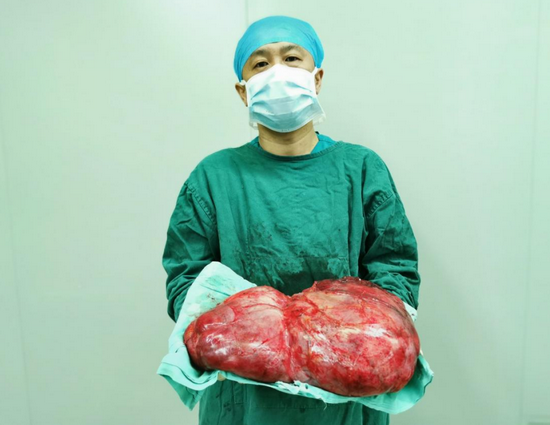 哈医大一院群力多学科专家联手完整切除罕见30厘米腹膜后巨大肿瘤