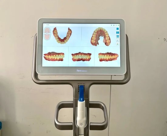 itero口内扫描仪