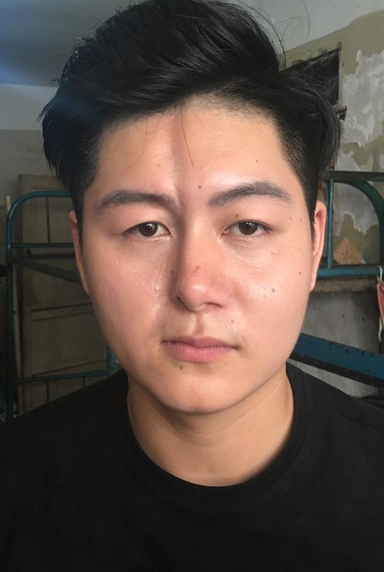 【新浪医讯】公益求助:谁能来帮帮"半面男孩"?