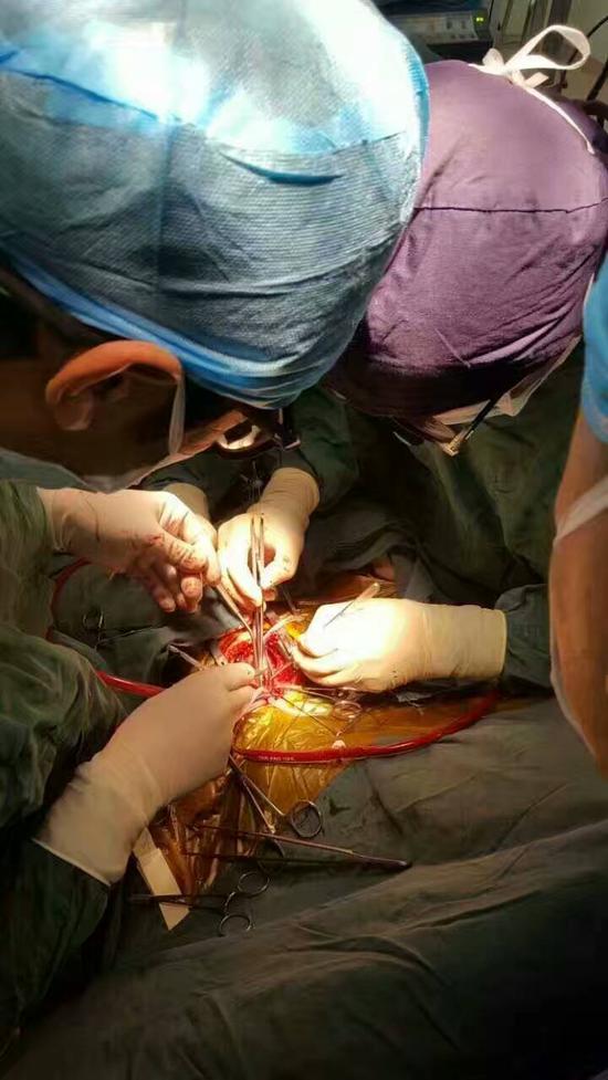 手术照片
