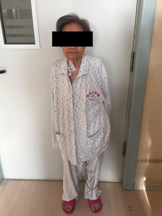 腹部膨隆呈蛙状腹,可见肠形,腹壁张力大致皮肤发亮