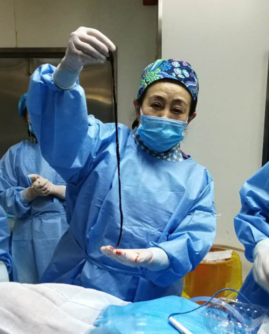 半米长血栓!黑龙江省医院下肢动脉取栓术保住患者一条腿