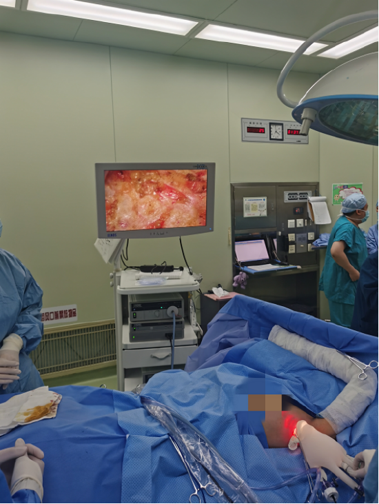 哈医大二院单孔腔镜非溶脂法乳腺手术切除巨大肿块乳此美丽恶性乳腺