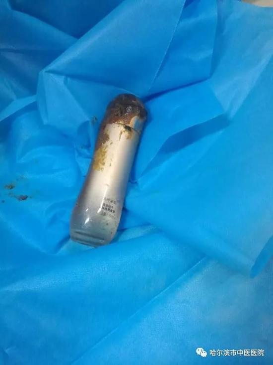 近日,哈尔滨市中医医院肛肠四病房收治了一位肛门异物行肛门切开术