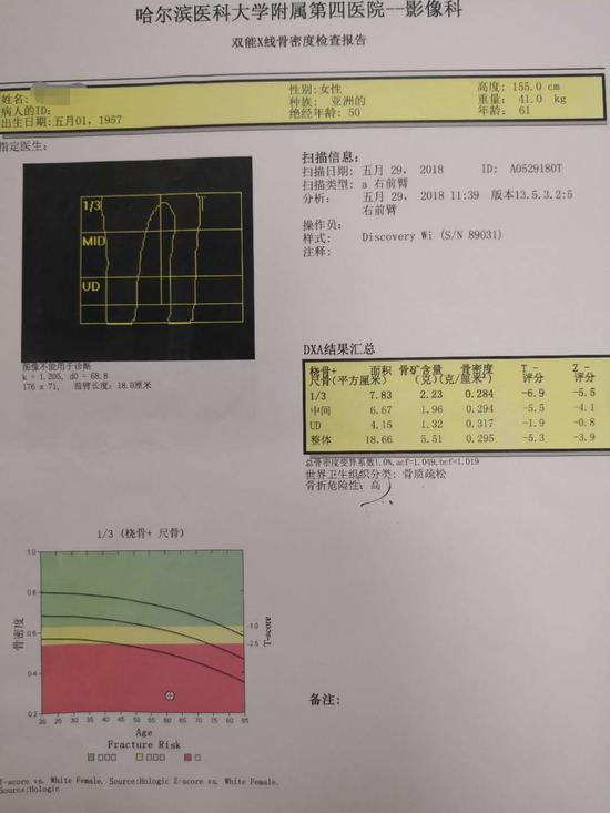 术前骨密度检测,提示患者较为严重的骨质疏松
