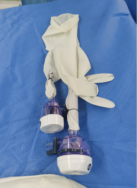 自研"乳腺单孔腔镜戳卡保护套"