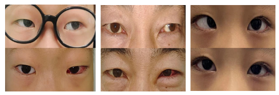 哈医大四院眼科开设斜视专科门诊
