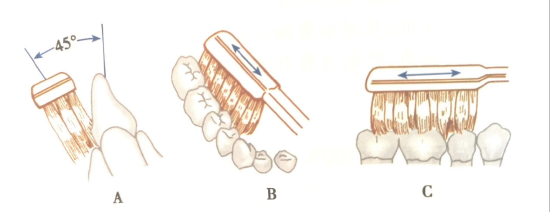 bass刷牙法示意图