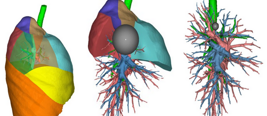 术前右肺解剖结构三维重建
