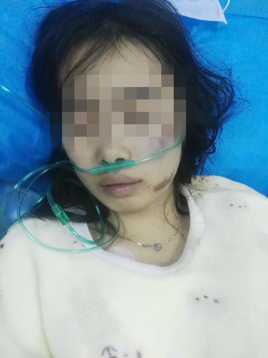 长沙女子吃卤菜险丧命警惕亚硝酸盐中毒