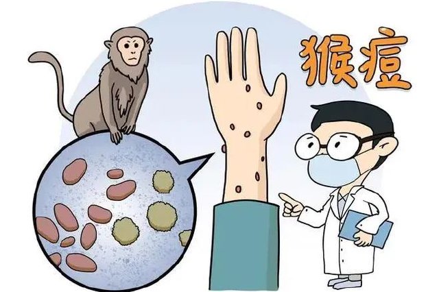 最新！江苏11月新增7例猴痘确诊病例